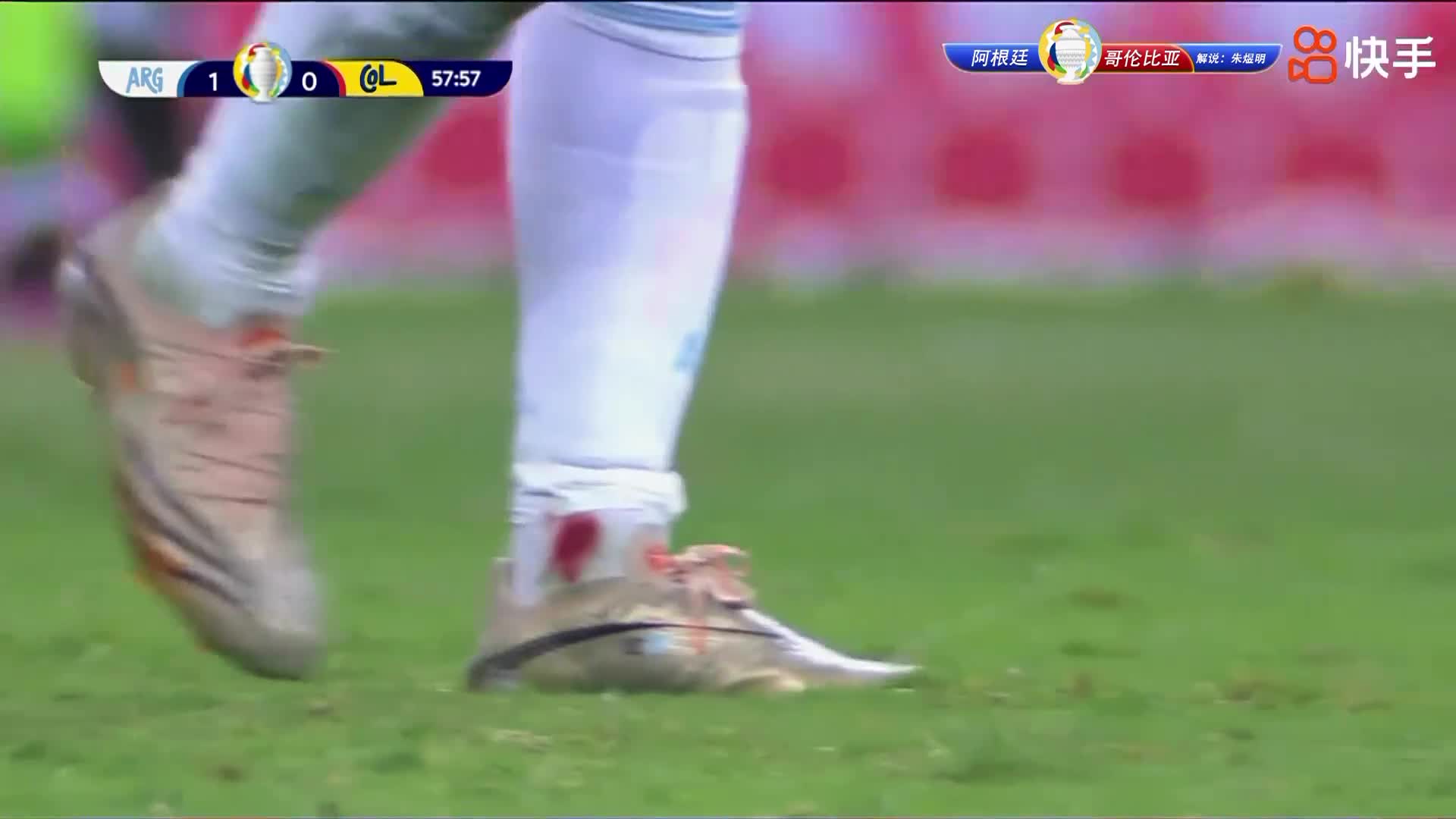 梅西左脚脚踝被蹬踏渗血坚持比赛