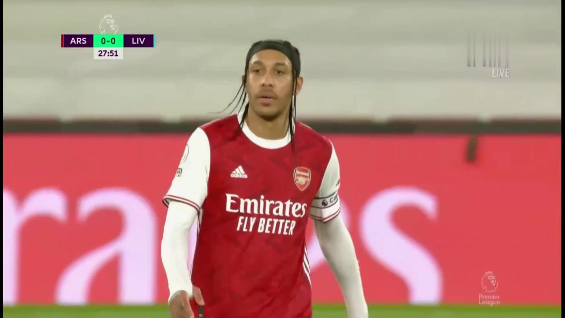 英超靓仔！奥巴梅扬这款发型适合你吗？（奥巴梅扬 发型）