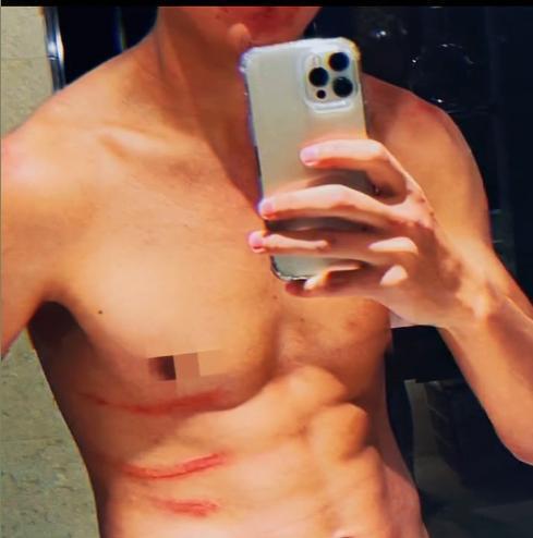 （阿不都海米提转会北京国安）亚泰新援阿不都海米提门线解围，社媒晒受伤照：努力的更幸运