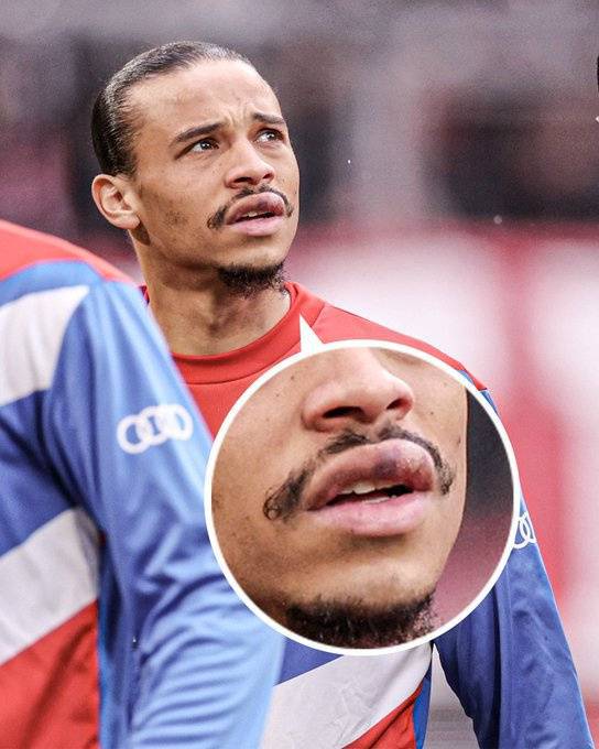 （拜仁球员萨内）拜仁全队状态持续走低 萨内血痕成为赛场焦点